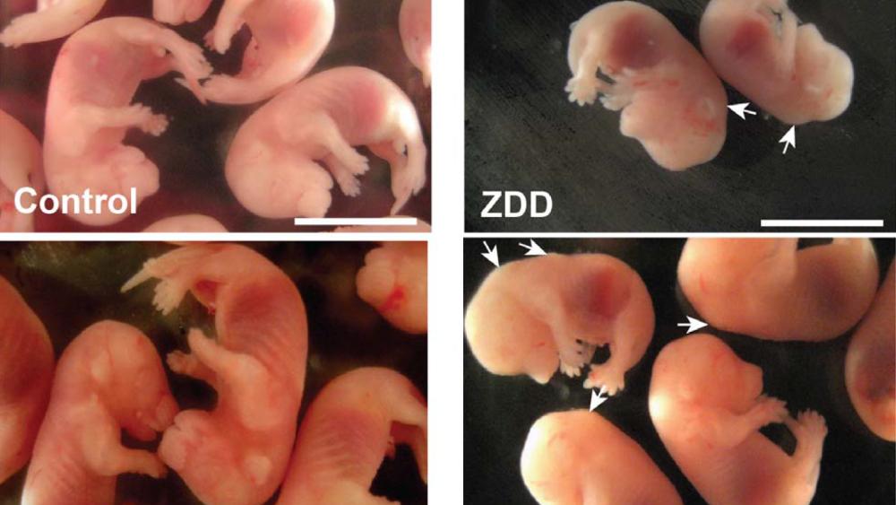 zinc light conception